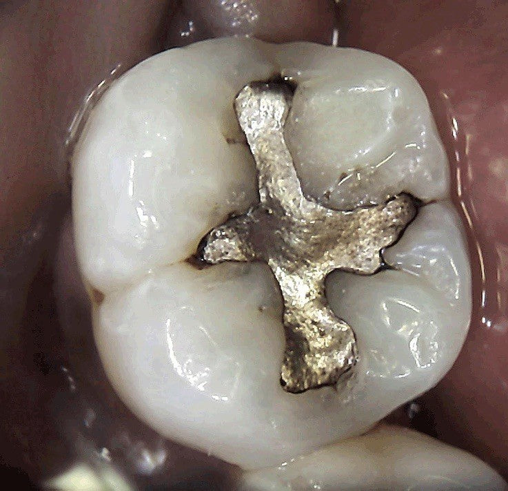 Carestream / Kodak CS1200 Intraoral camera - cs 1200 -Wow!
