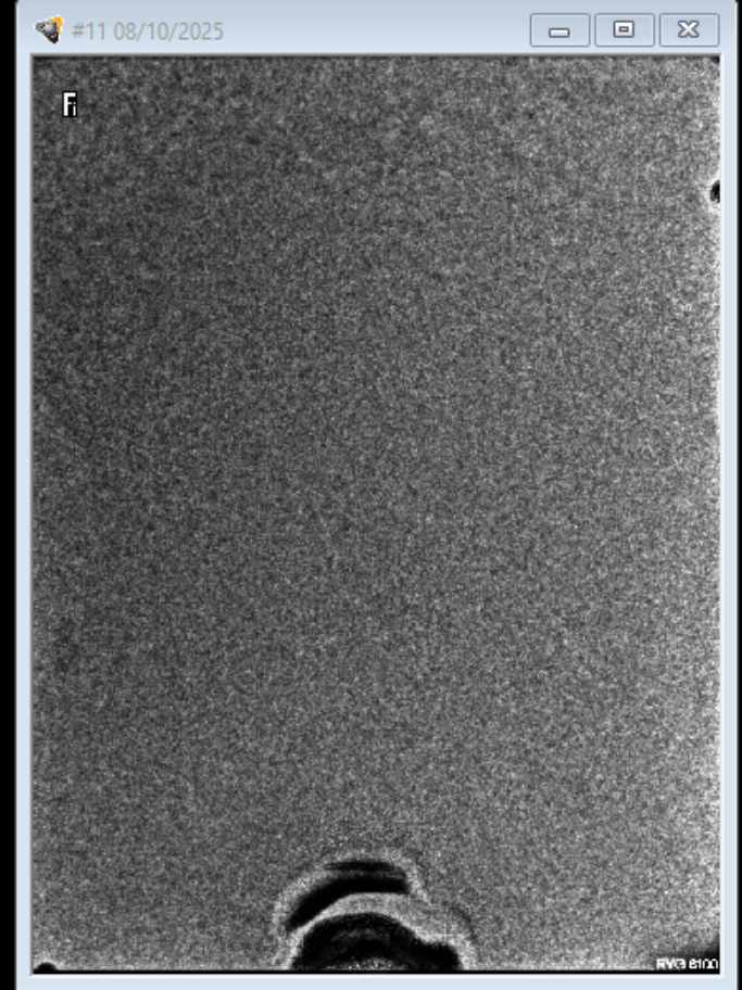 Carestream Kodak RVG 6100   size 1 (See Images and description)